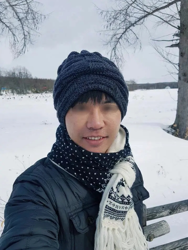 男性隆鼻+下巴手術案例,博恩妍